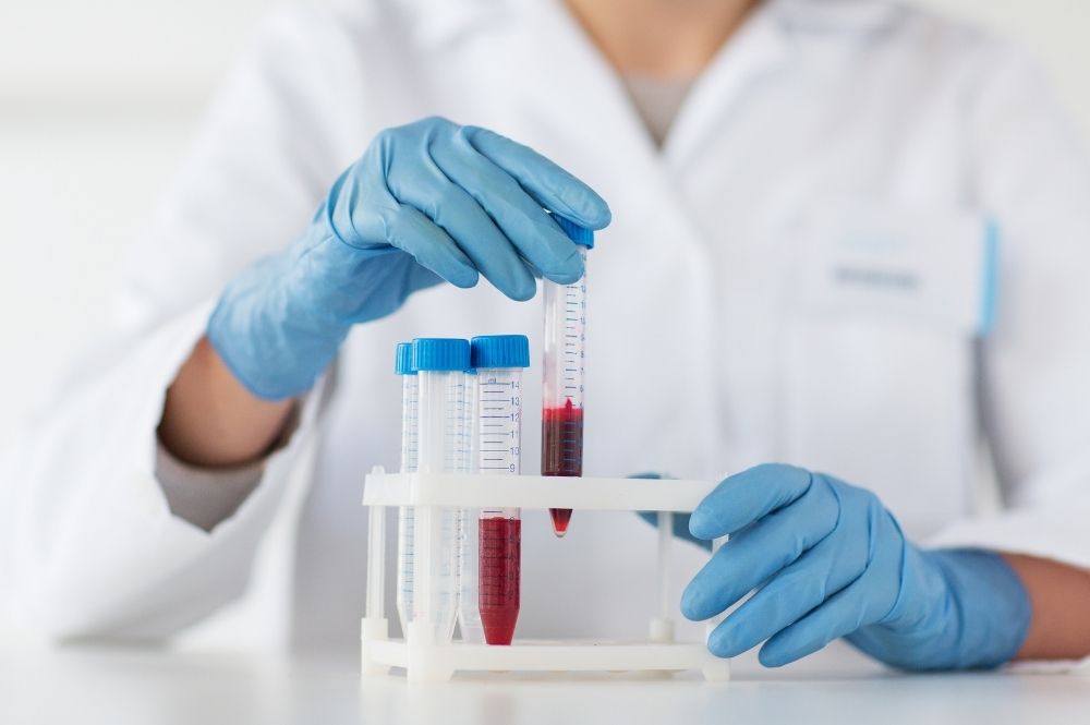 A blood work lab technician hold test tubes filled with blood. The lab technician is wearing blue rubber gloves and a white lab coat.